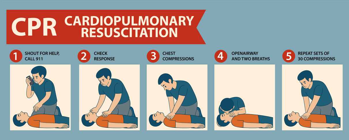 How to Respond to Cardiac Arrest – A Step-by-Step CPR Guide Image